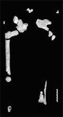 Skeleton,  Le Regourdou