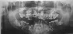 TEETH