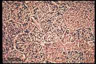 Microstructure