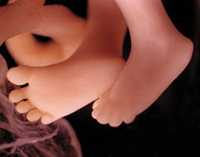 Abortion
