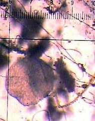 Placozoan from Guam, roughly 400 microns across