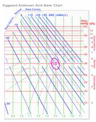 Siggaard-Andersen Diagram