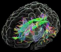 Brain Image
