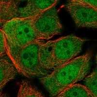 Click to enlarge image Results provided by the Human Protein Atlas (www.proteinatlas.org).  The subcellular location is partly supported by literature or no literature is available. Immunofluorescent staining of human cell line MCF7 shows localization to nucleoplasm & cytosol. Human assay: HeLa fixed with PFA, dilution: 1:2000Human assay: MCF7 fixed with PFA, dilution: 1:2000Human assay: U-2 OS fixed with PFA, dilution: 1:2000