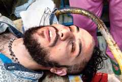 Paribaha Mukhopadhyay, one of the two junior doctors at NRS Medical College and Hospital who was injured in the attack on Monday night