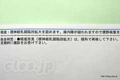 視神経乳頭陥凹拡大？ - 人間ドックの結果に要精密検査の項目があったので・・・