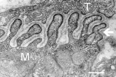 Electron_micrograph_of_neuromuscular_junction_(cross-section)