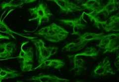 Glial cells