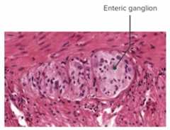 Histology image of an enteric ganglion