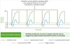 Invasive mechanical ventilation Airway pressure tracings in the main modes of ventilation