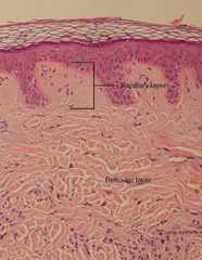 Layers of the dermis
