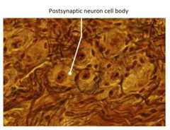 Neuron cell body
