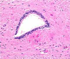 Columnar ependymal cells