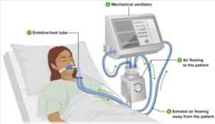 Standard ventilator setup Standard ventilator setup