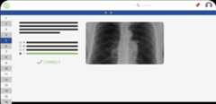 Usmle step 1 composition platform showing correct chest x-ray diagnosis.