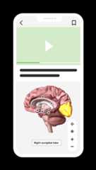 Smartphone displaying usmle step 1 brain anatomy lecture with highlighted right occipital lobe.