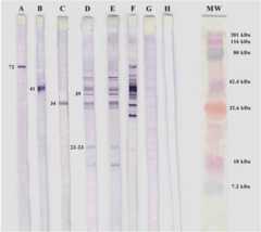 Western blotting of B. burgdorferi