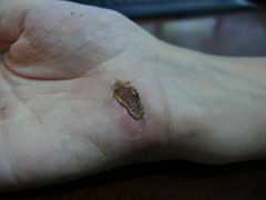 Wound healing day 12