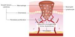 Inflammation and resorption