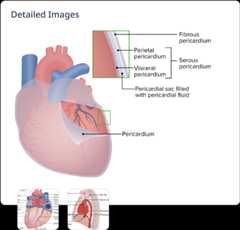 Detailed illustration of heart pericardium anatomy and layers.