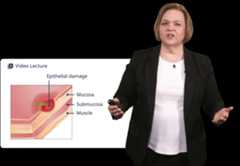 Woman presents skin tissue damage diagram with labels.