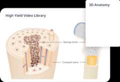 Cross-section of bone tissue showing spongy and compact bone.