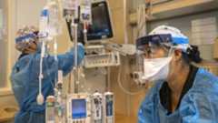 two nurses wearing protective equipment work in the ICU