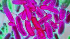 E. Coli bacteria imaged under an electron microscope