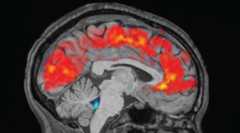 Grey scale brain scan showing changes in blood flow in red and cerebrospinal fluid in blue.