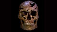 a reconstructed human skull facing the viewer against a black background