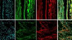 A series of 8 boxes showing various cell types with some blue tinted, some green tinted, and some red tinted