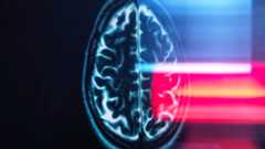 Refection of MRI brain scan on monitor display.