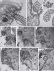 Flagellar apparatus structure in the nibblerids Nibbleromonas kosolapovi