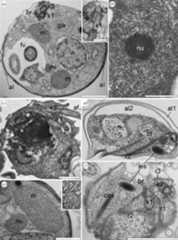 Ultrastructure of the nibblerids Nibbleromonas quarantinus