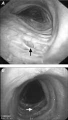 graphic file with name 25FF2.jpg