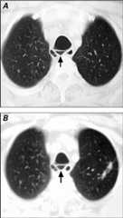 graphic file with name 25FF1.jpg