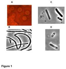 A, colonies on sheep blood TGY agar surrounded by hemolysis halo. Phase contrast microscopy (objective x100) of culture in TGY broth in the exponential growth phase (B), stationary phase (C), and sporulation phase (D).