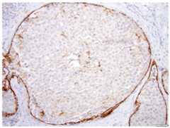 Fig 12