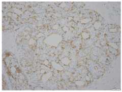 Fig 16
