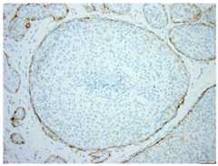 Fig 14