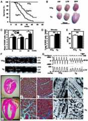 graphic file with name cdg601f3.jpg