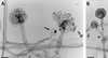 FIG. 11