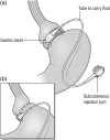 Fig. 1