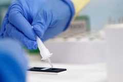 Virus korona potvrđen kod sedam osoba u Srpskoj