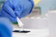 U Srpskoj zaraženo još pet osoba, preminule dvije