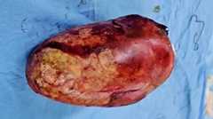 تصاویر جنین مومیایی درون بدن مادر مشهدی