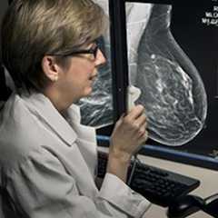 Après avoir subi une mastectomie, 30 % des femmes ont recours à une reconstruction mammaire. © DR