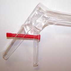 Le spéculum est un instrument classique dans l'examen gynécologique. © Ceridwen, Wikipédia, cc by sa 2.0