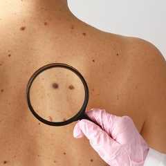 Si la surveillance régulière reste le meilleur moyen de dépister un cancer de la peau, prévenir reste la clé : crème solaire, vigilance et suivi dermatologique sont essentiels. Et désormais, une nouvelle étude américaine laisse entrevoir qu’un simple complément pourrait renforcer cette protection et réduire le risque. © Pixel-Shot, Adobe Stock