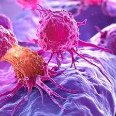 Les métastases : quand le cancer s’étend et change la donne. ©&nbsp;Sam Adobe Stock